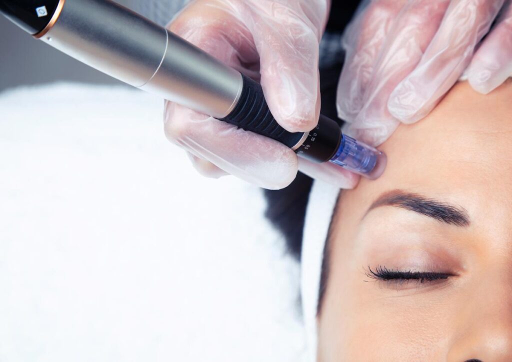 Booking for microneedling / mesotherapy lift in Geneva 1 microneedling treatment in geneva - beauty art pro