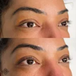 avant et après le rehaussement de cils - beauty art pro 8