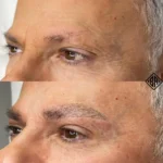 Avant et après le microblading et le microshading - beauty art pro 2